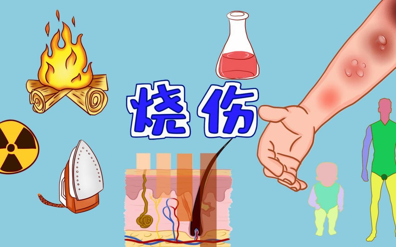 烧伤应该如何进行护理? - 知乎
