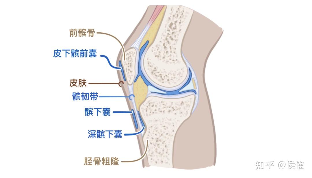 为什么无论什么运动似乎都容易伤膝盖,膝盖这么脆弱是人体的 bug 吗?