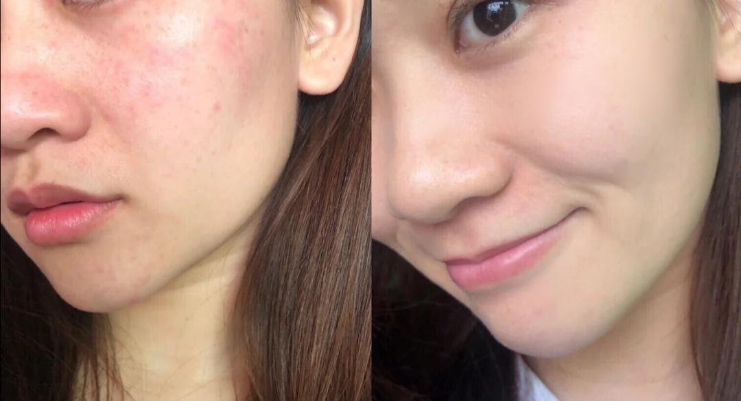 适合学生党敏感肌使用的护肤品