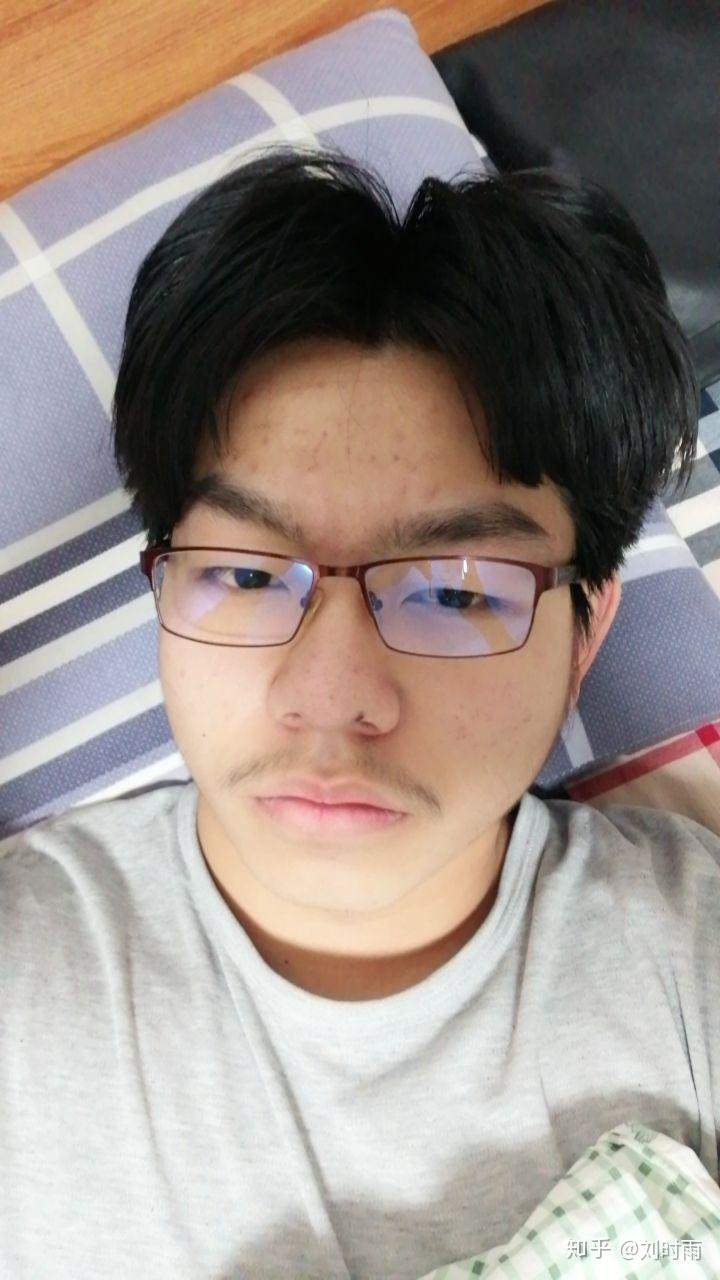 到底怎样才能算内双肿眼皮