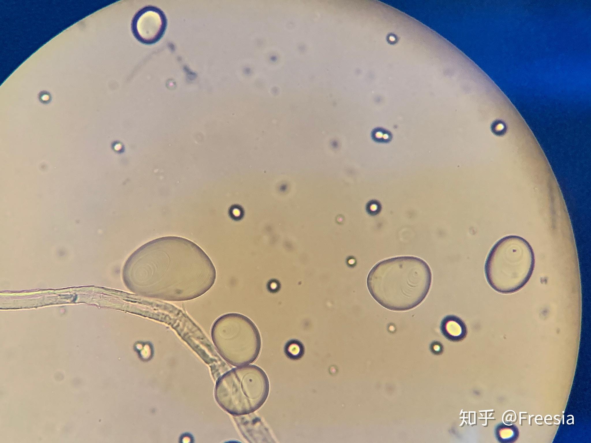 关于单粒淀粉粒,复粒淀粉粒,半复粒淀粉粒的结构? - 知乎