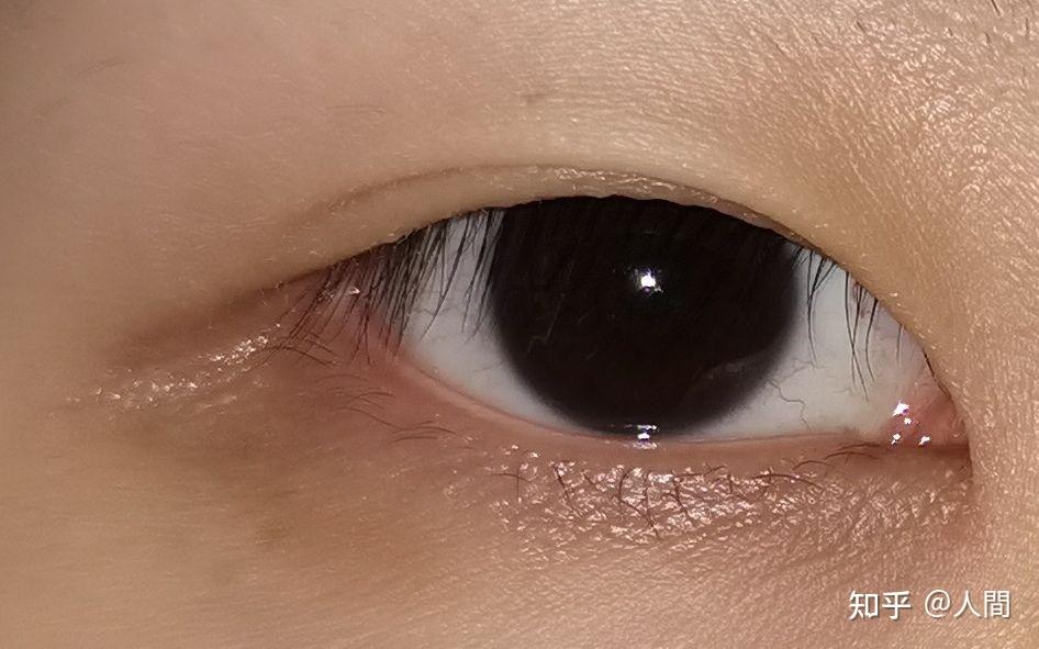 看别人的瞳孔都是褐色茶色觉得好漂亮啊?