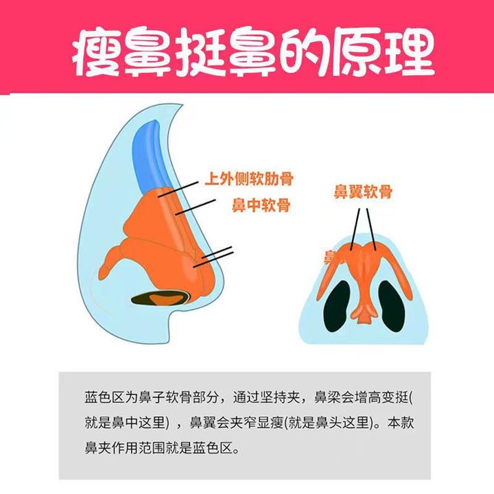 从鼻尖软组织的生物力学特性分析美鼻夹效果 - 知乎