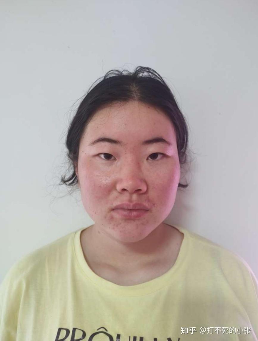 女生长得很丑怎么办,超级自卑? - 知乎