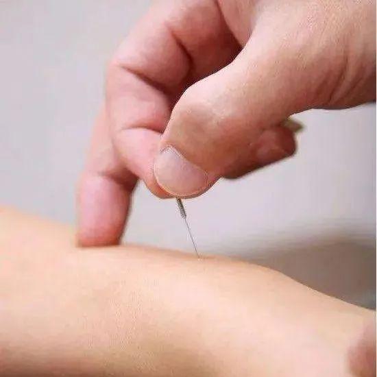 祖传一针治腰突腰疼特效一针疗法