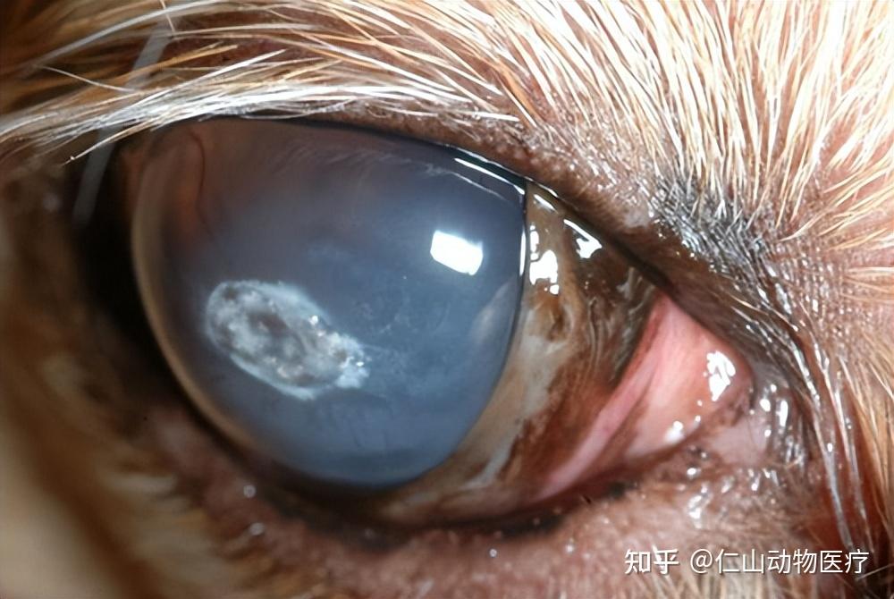 上海哪里能买到角膜绷带镜?