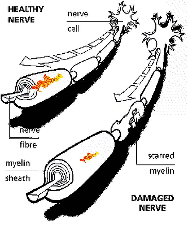 为什么地球上大部分的脊椎动物都是一个头两只眼一个