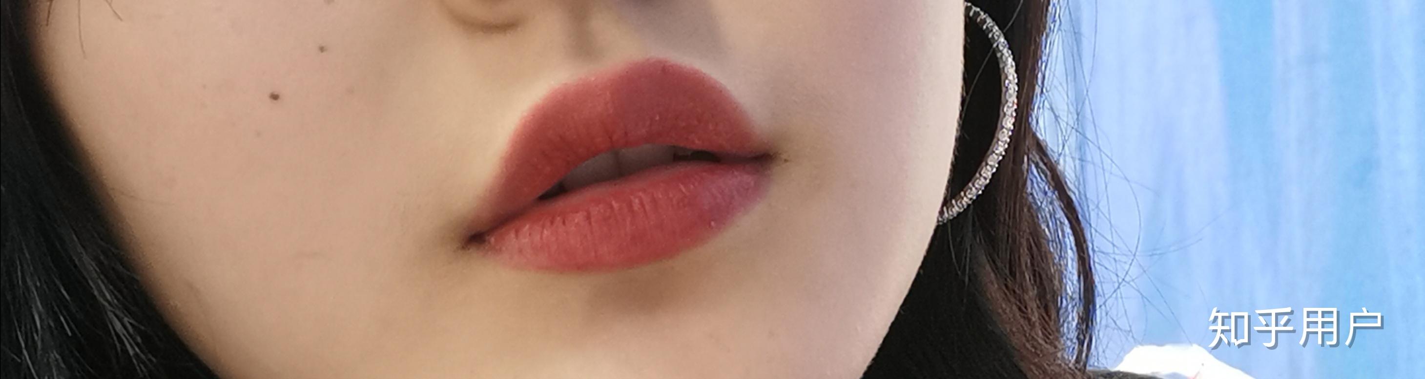 上嘴唇上翘上翻怎么办侧面看起来简直丑哭我