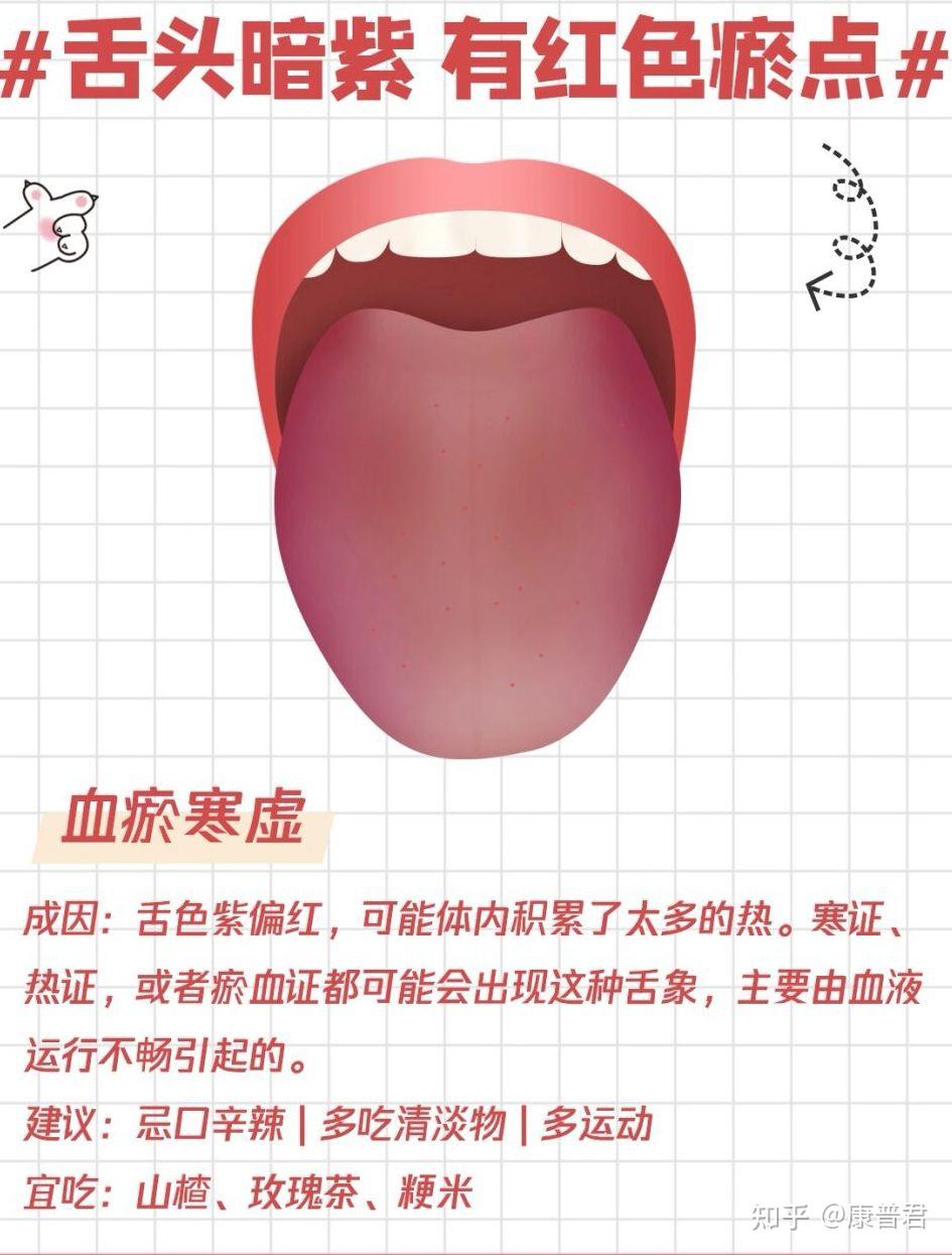 一张图让你简单看懂中医舌诊!
