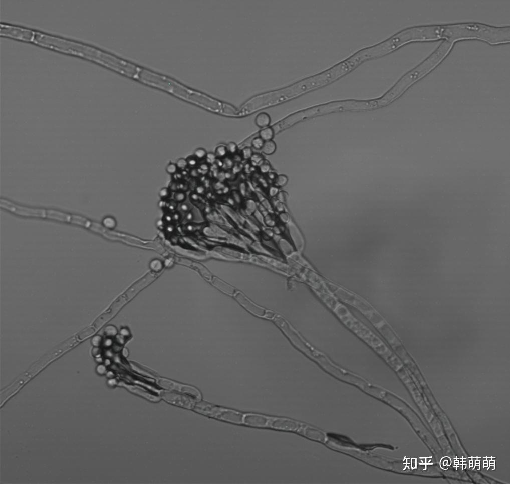 如何做才可以觀察到真菌的分生孢子梗產生分生孢子的圖片