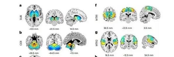 Nature Mental Health：研究人员发现了使用 fMRI 扫描识别精神障碍特征的新方法 - 知乎