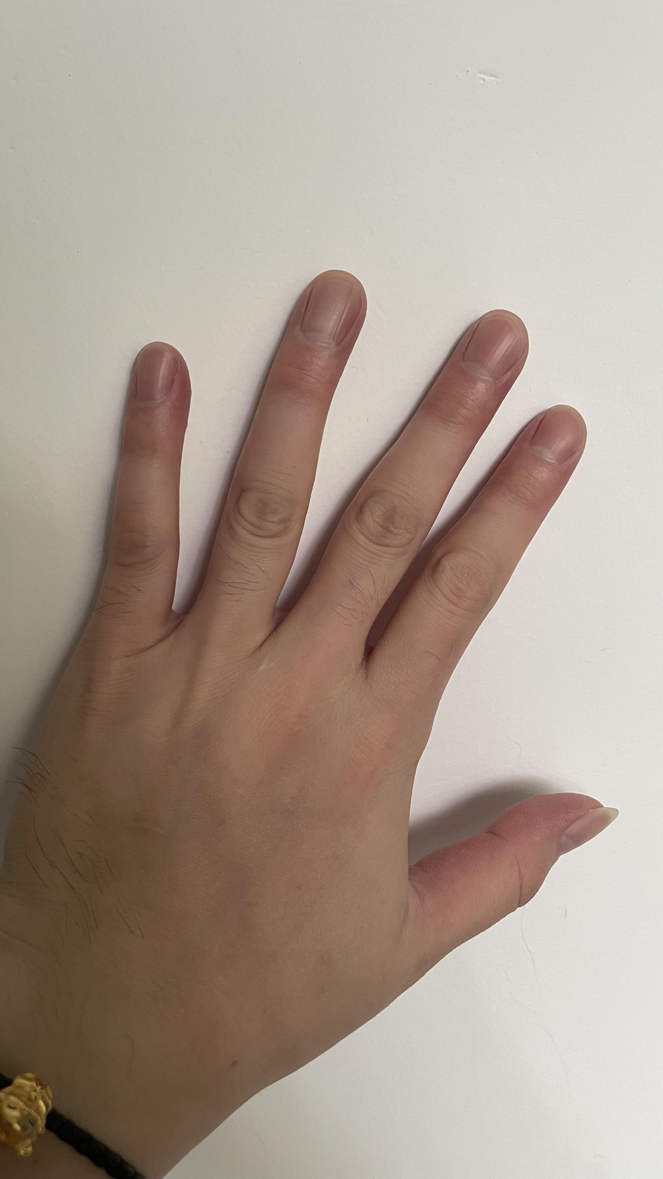 学吉他伤左手手指吗