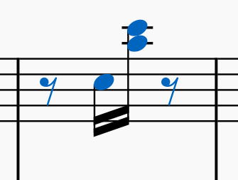 李斯特钟 知乎 李斯特钟 知乎