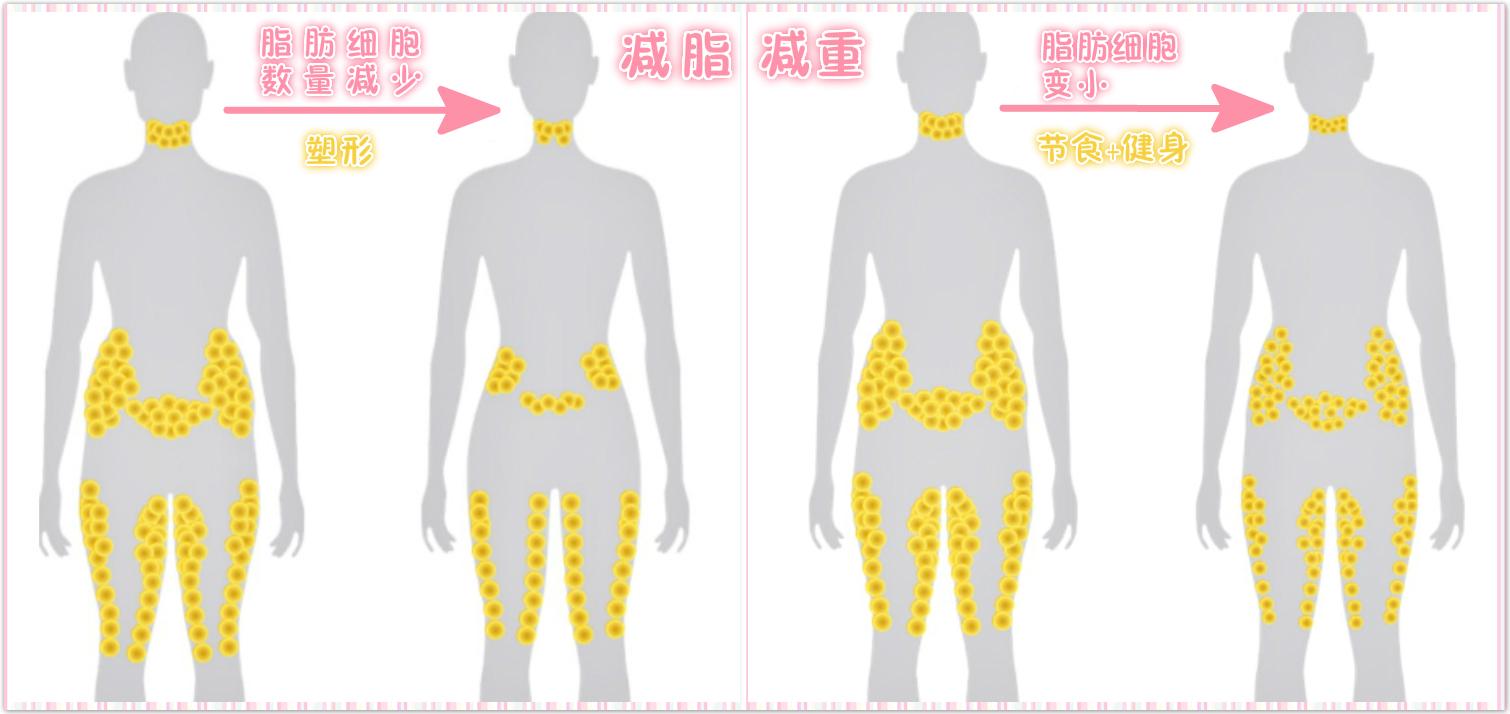 脸部脂肪堆积严重但是身体很瘦普通减肥能够解决吗