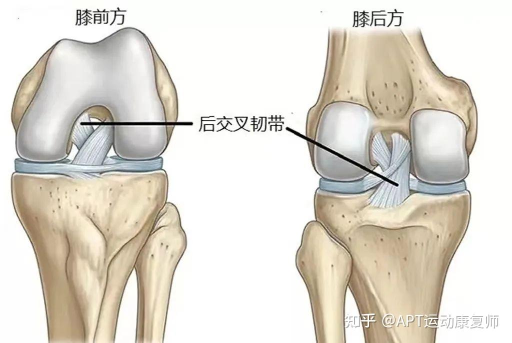 后交叉韧带手术痛吗做完后能激烈运动吗