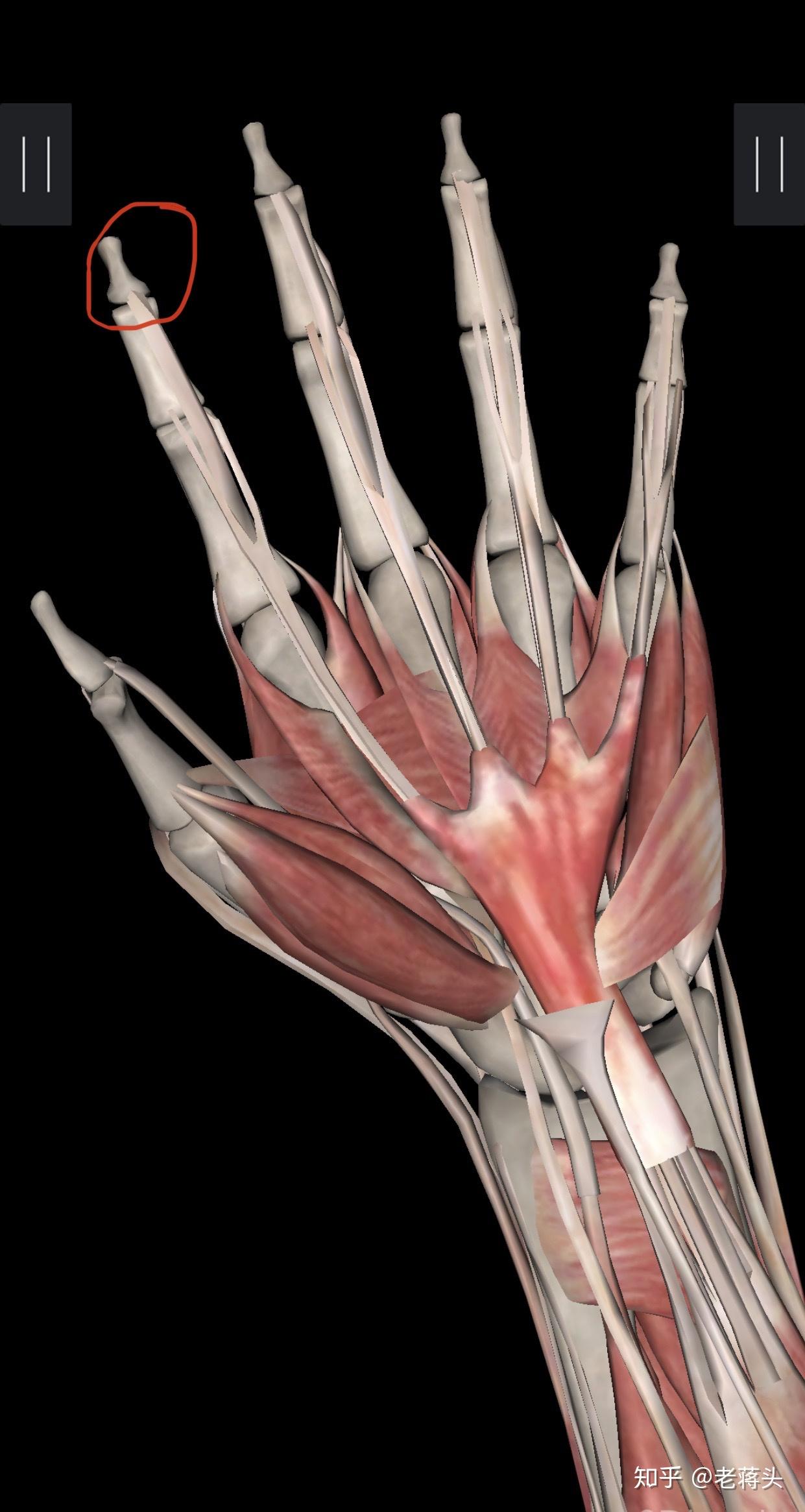 食指第一关节的肌腱断裂,后面的关节会不会受到影响?