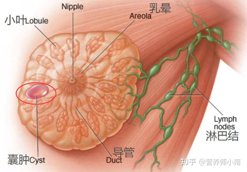 严重乳腺增生和乳房结节一起出现的话,癌变可能性有多大?