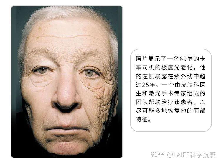 夏日防晒新思路，NMN让你无惧“光老化“ - 知乎