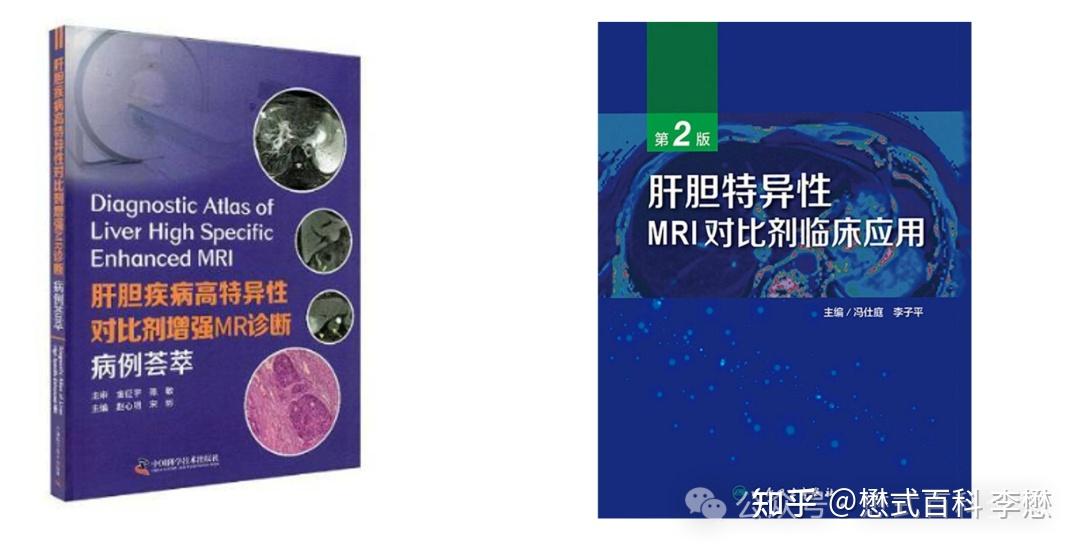 肝胆特异性对比剂增强扫描临床解析 - 知乎