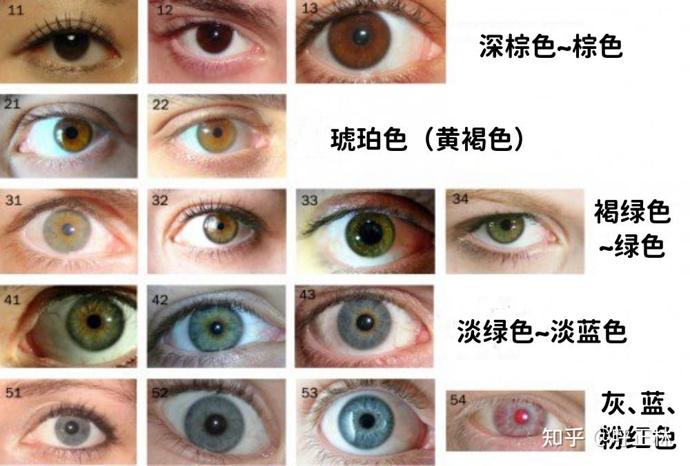 这个虹膜算是什么颜色