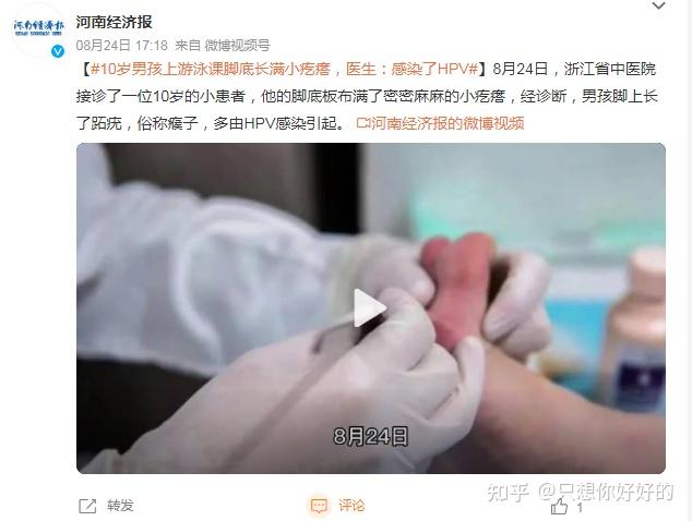10岁男孩长满“瘊子”?别以为HPV只偷袭成年人,小孩子也一样 - 知乎