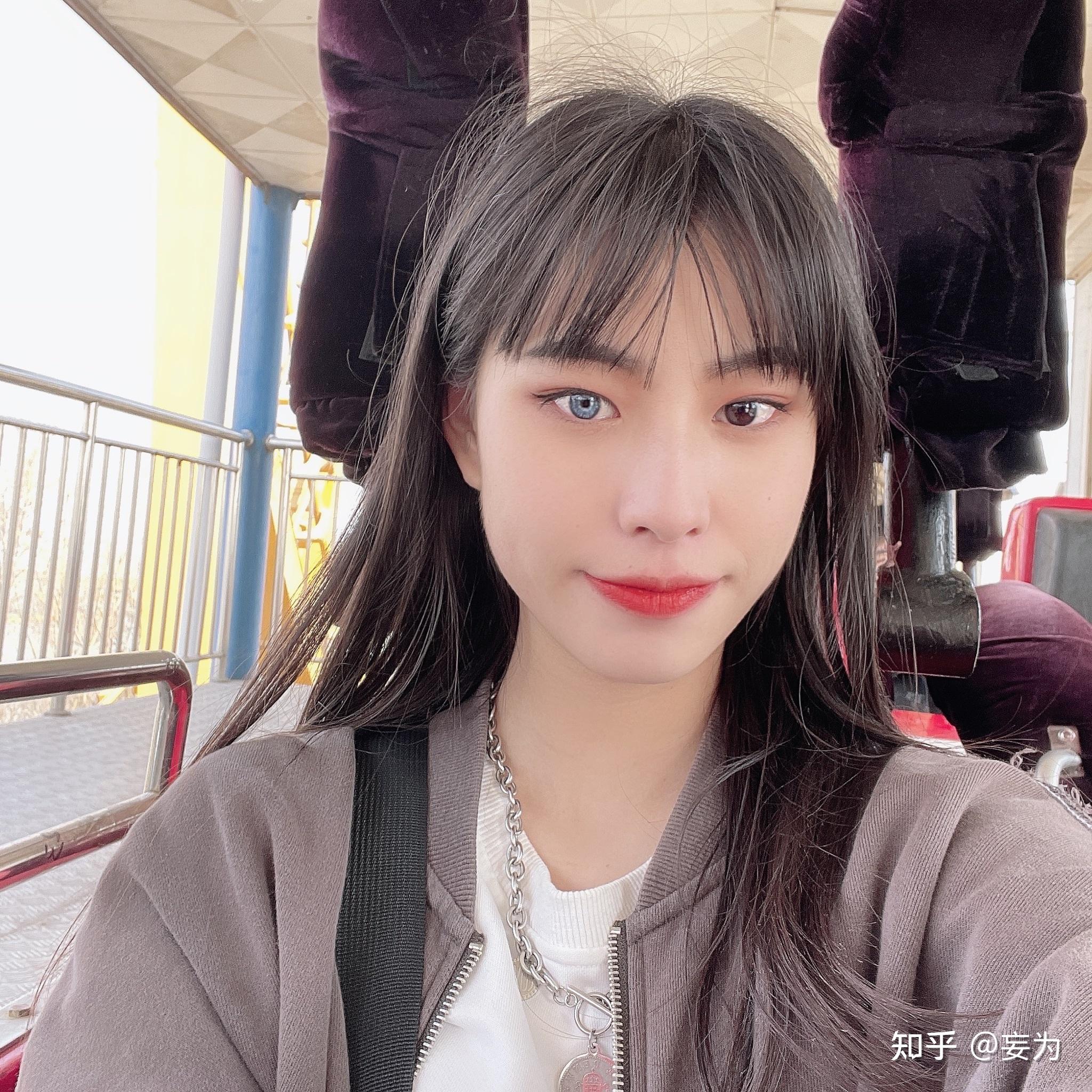 虹膜异色是种什么样的体验