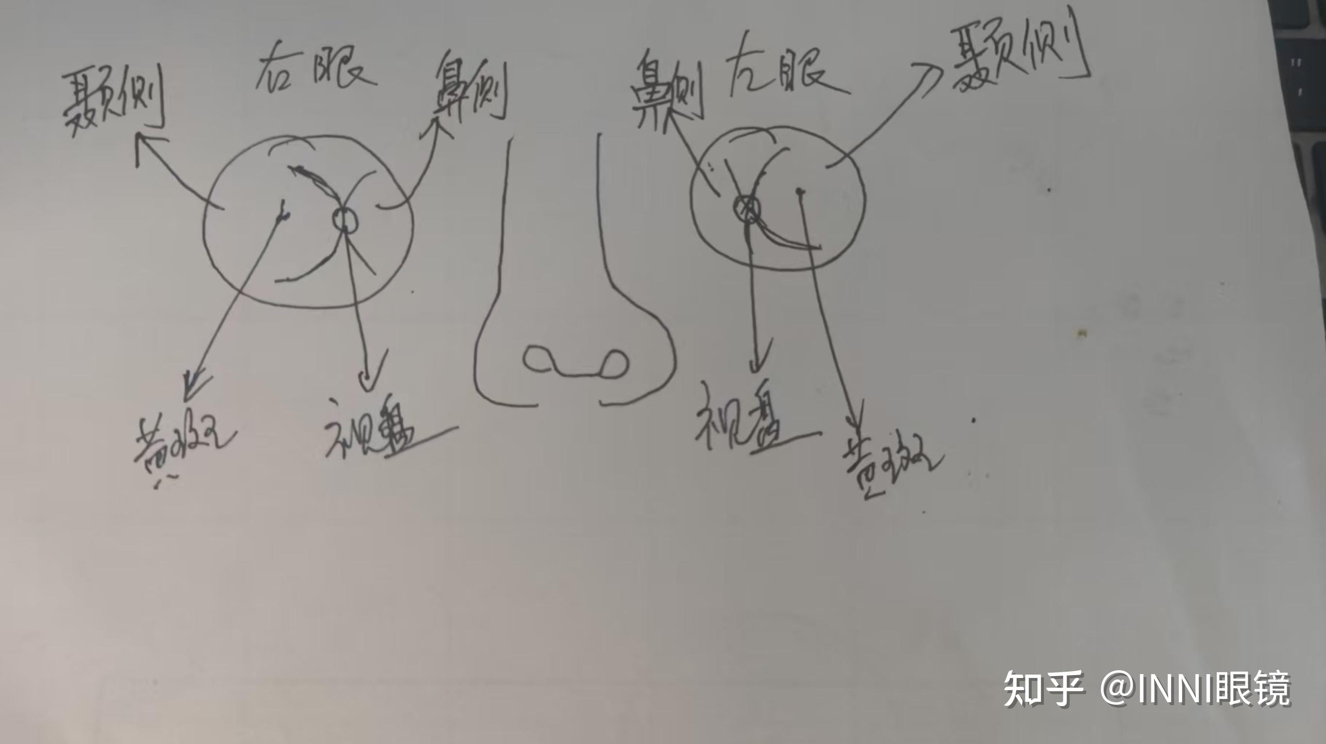 眼底照片怎么看左右眼? - 知乎