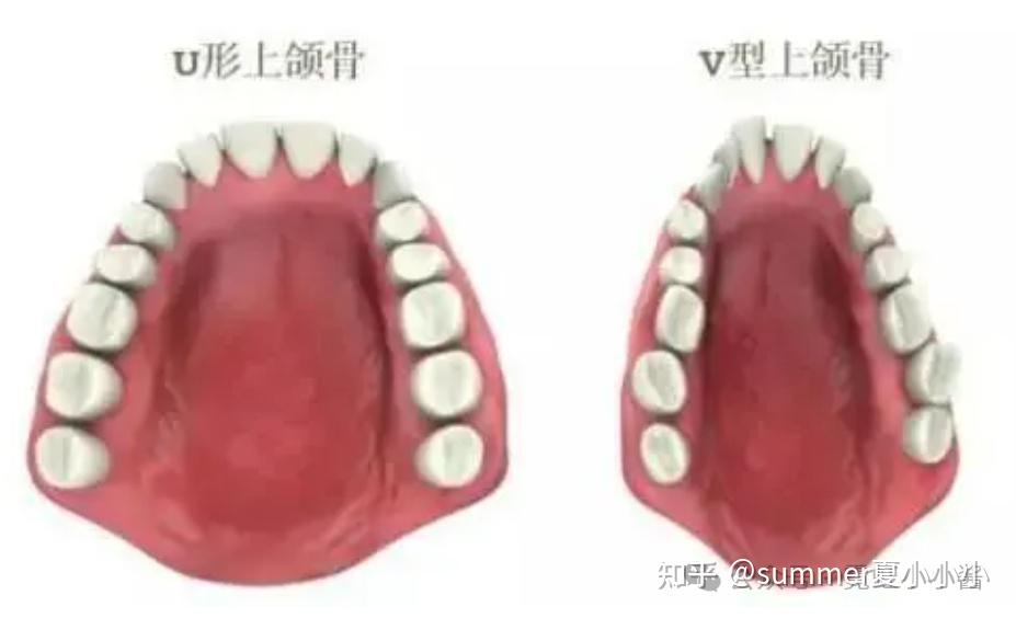 舌头贴上颚,能让鼻基底变高、脸变立体变好看? - 知乎