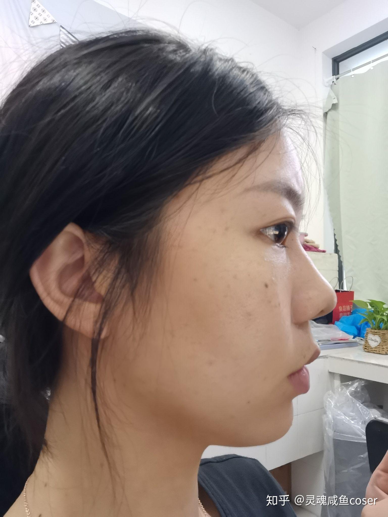 为什么我的侧脸,会这么平? - 知乎