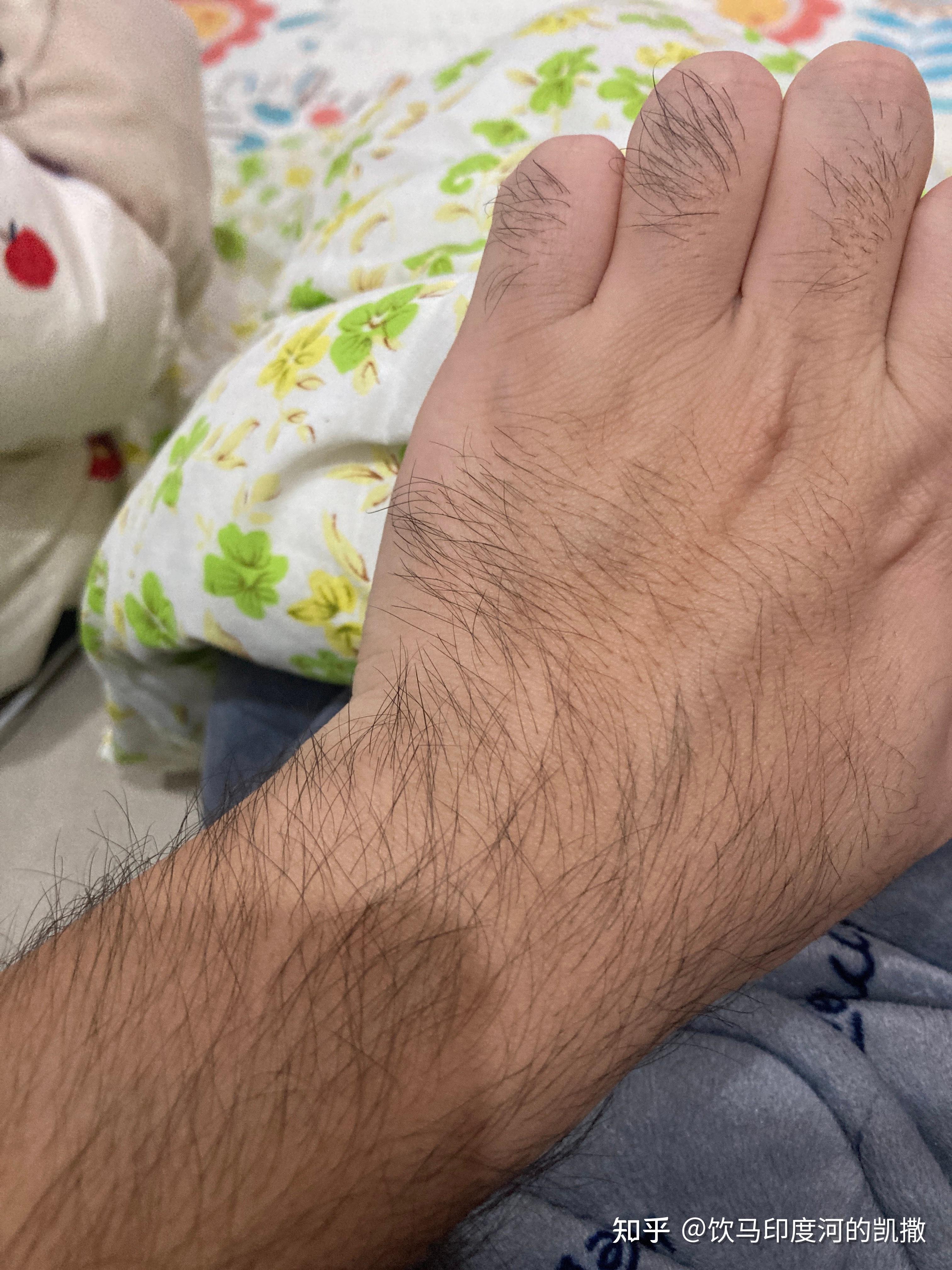 体毛旺盛是种怎样的体验?