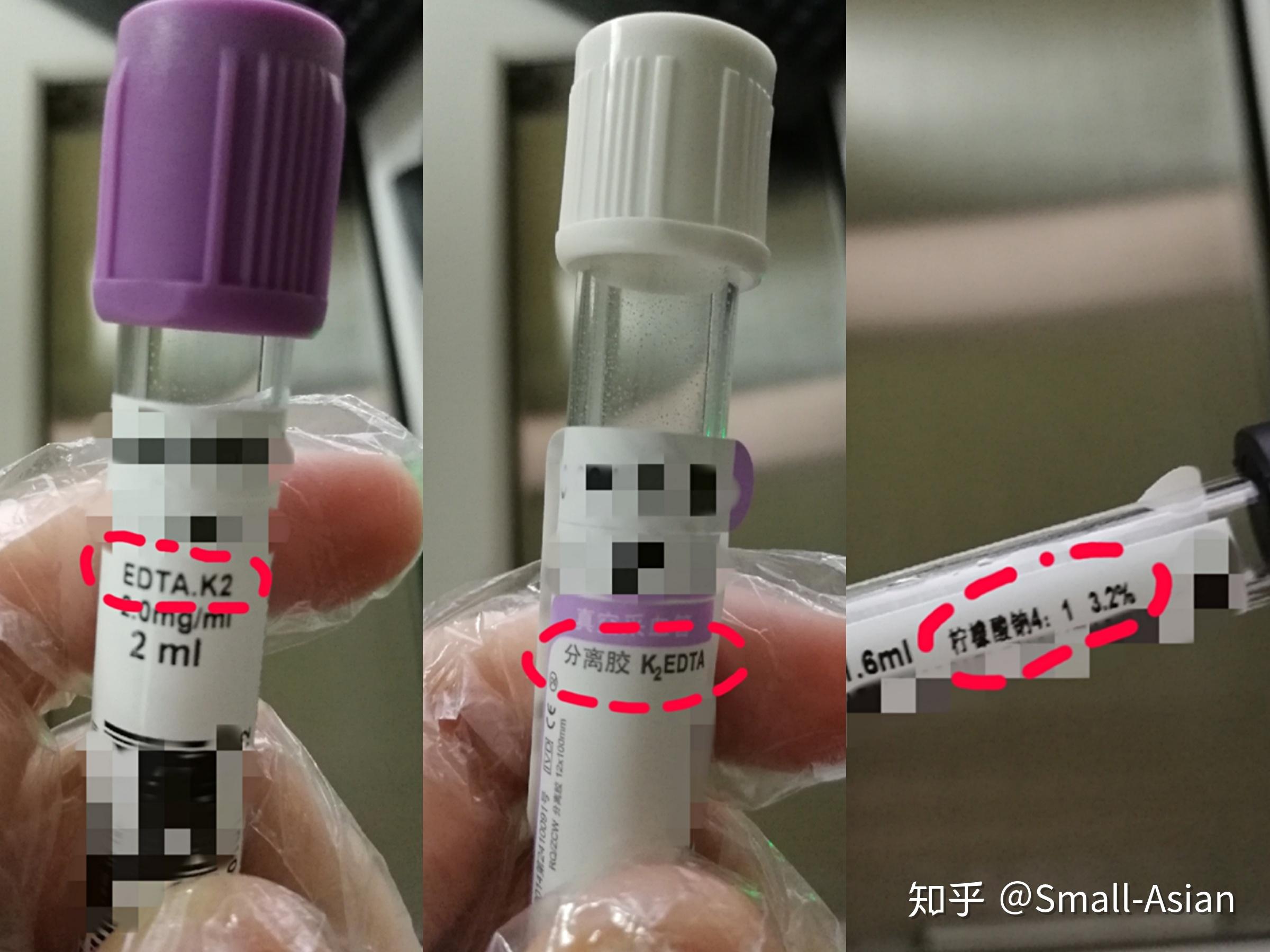 小公司安排了体检,我看到抽血装血液的瓶子好像不干净(黄色的小点)