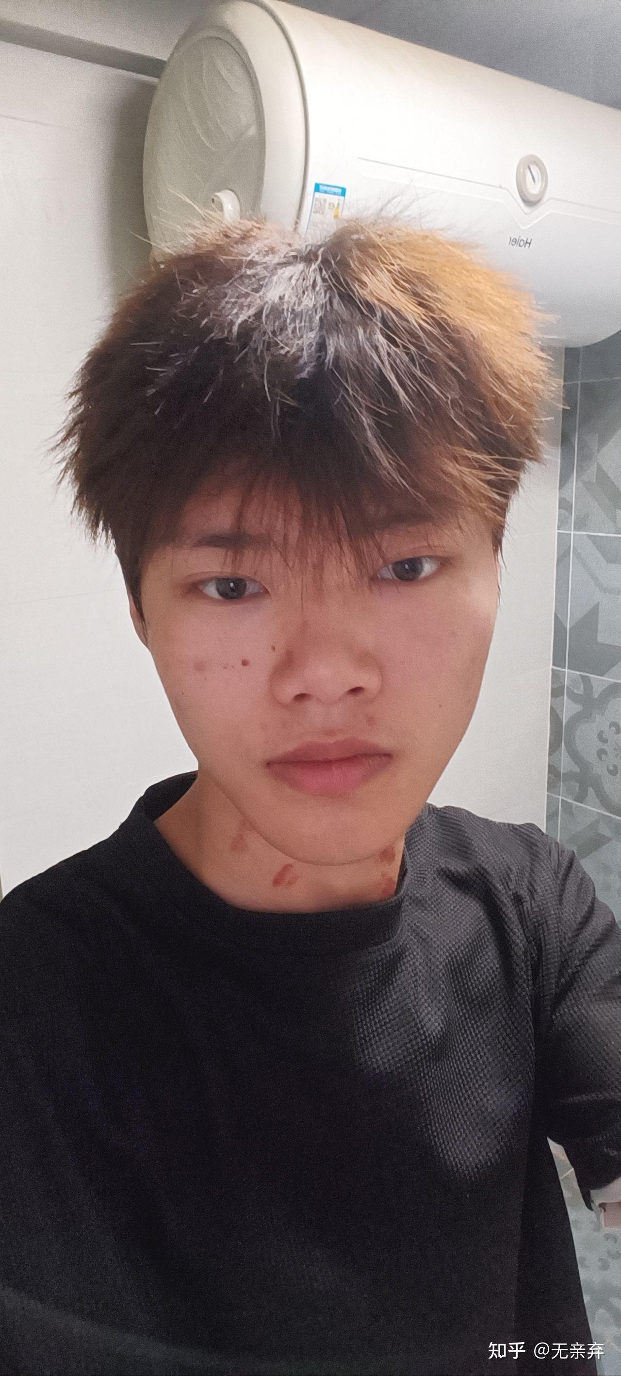 有没有长得丑的男生照片分享一下.我想知道什么样算丑 ? - 知乎