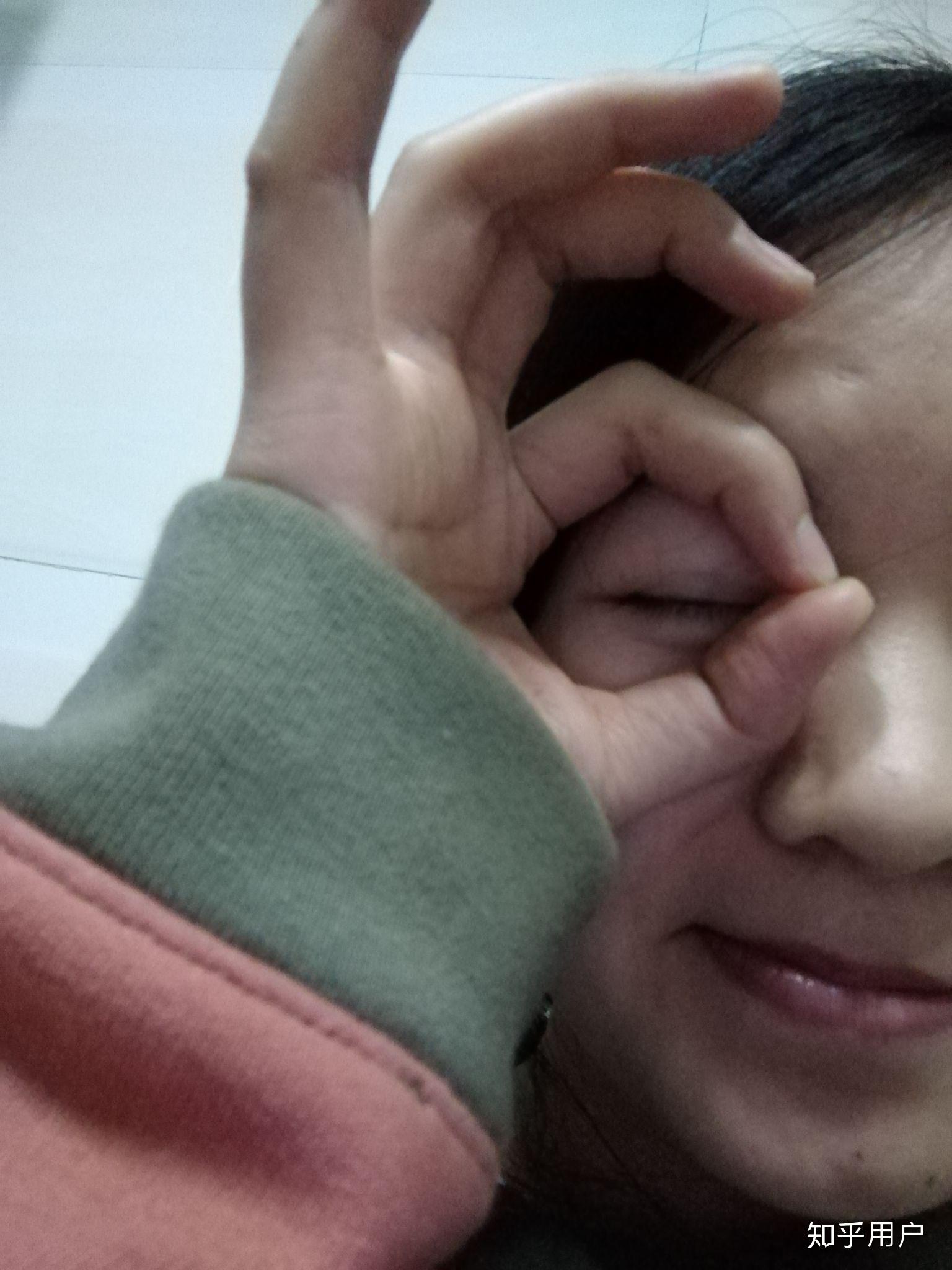 单眼失明是种怎样的体验? - 知乎