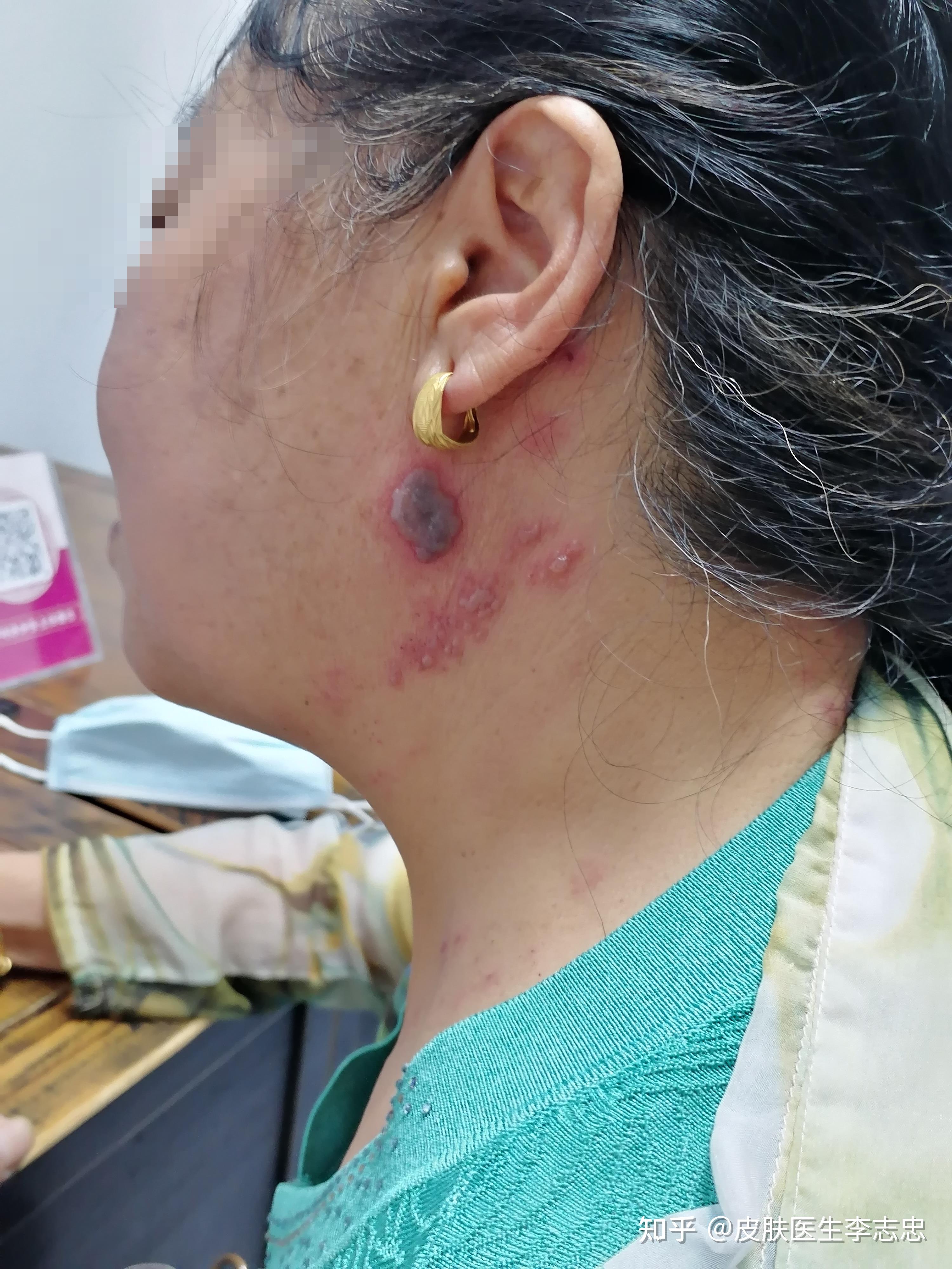 精神病人的症状能治好吗知乎的简单介绍