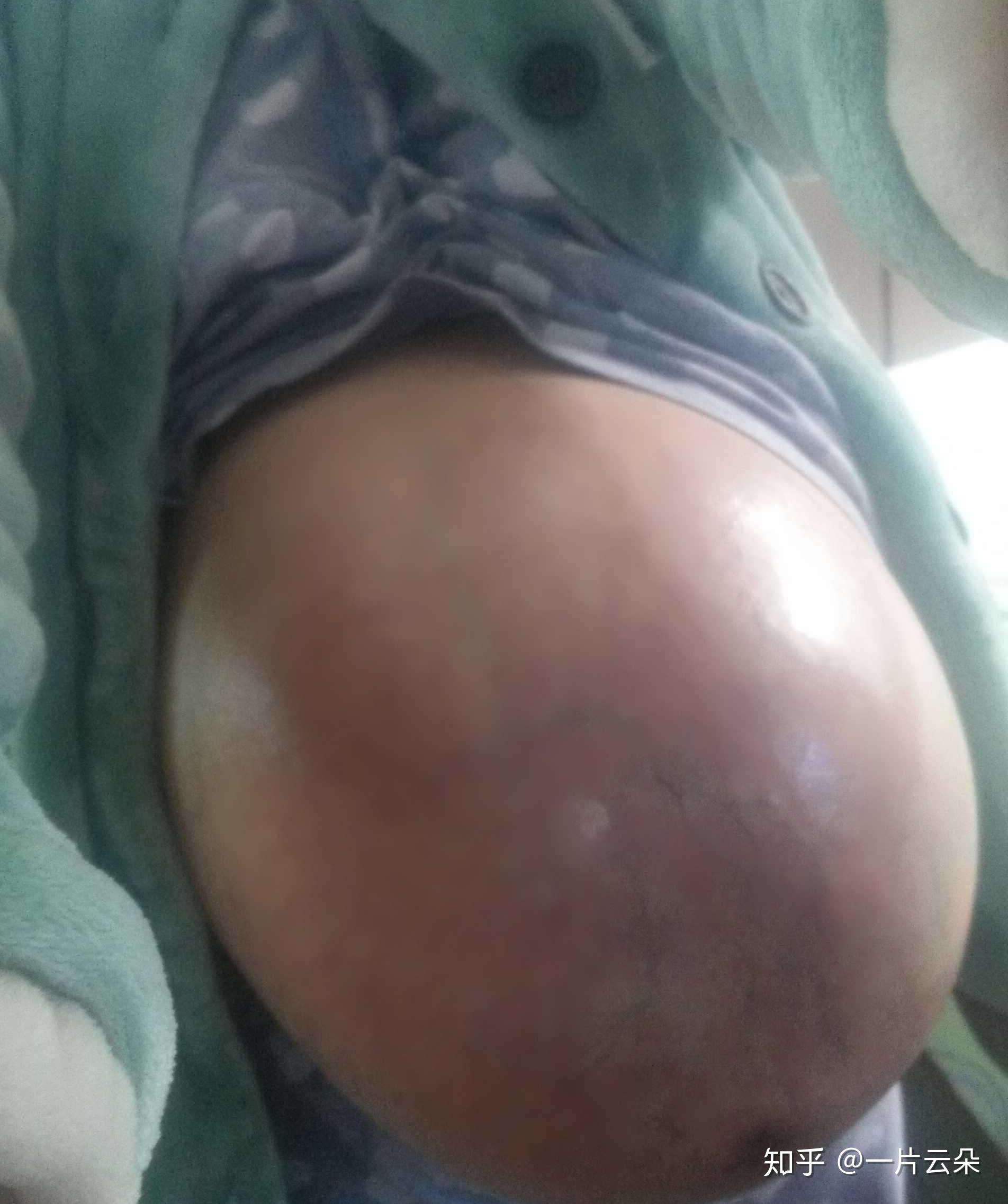 怀双胞胎后期肚子会特别大吗