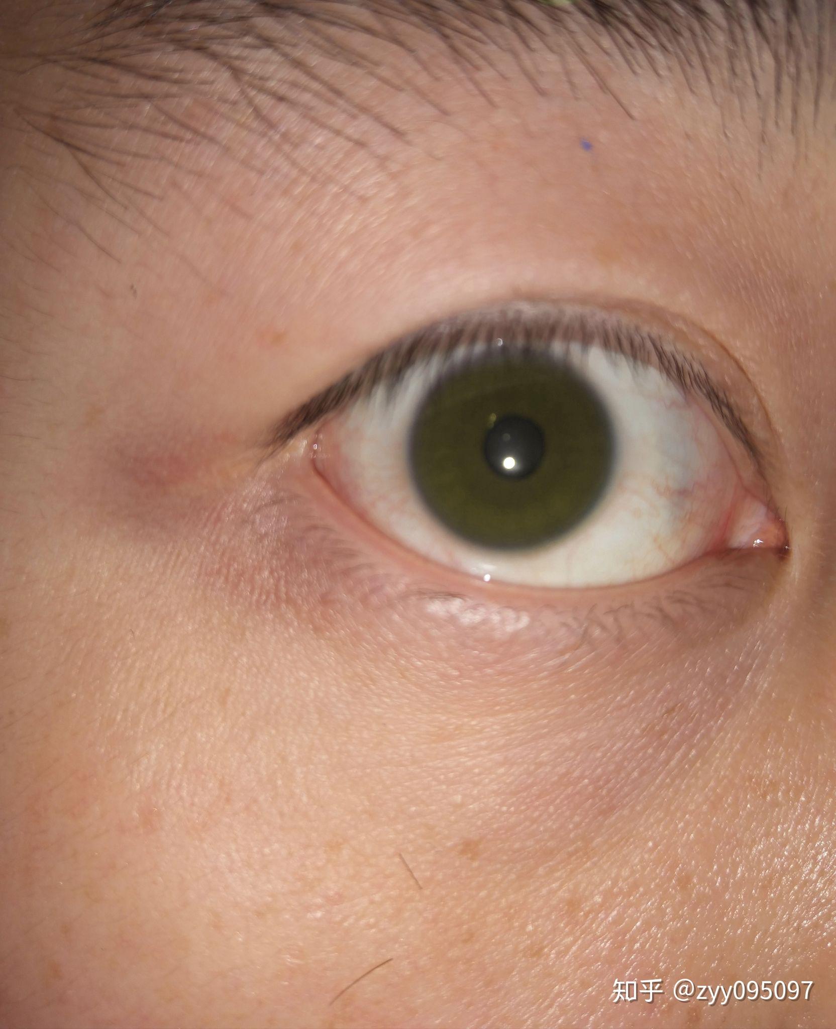有和我一样天生绿眼睛的中国人么