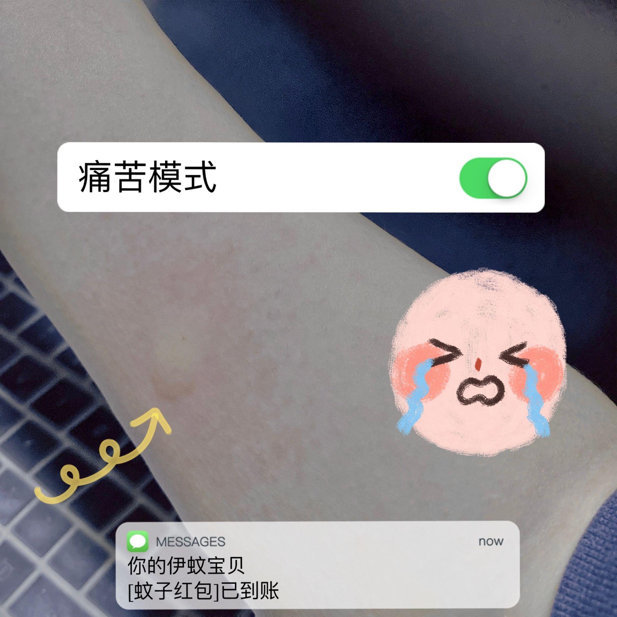 大家有被蚊子叮包后的奇葩照片吗? - 知乎