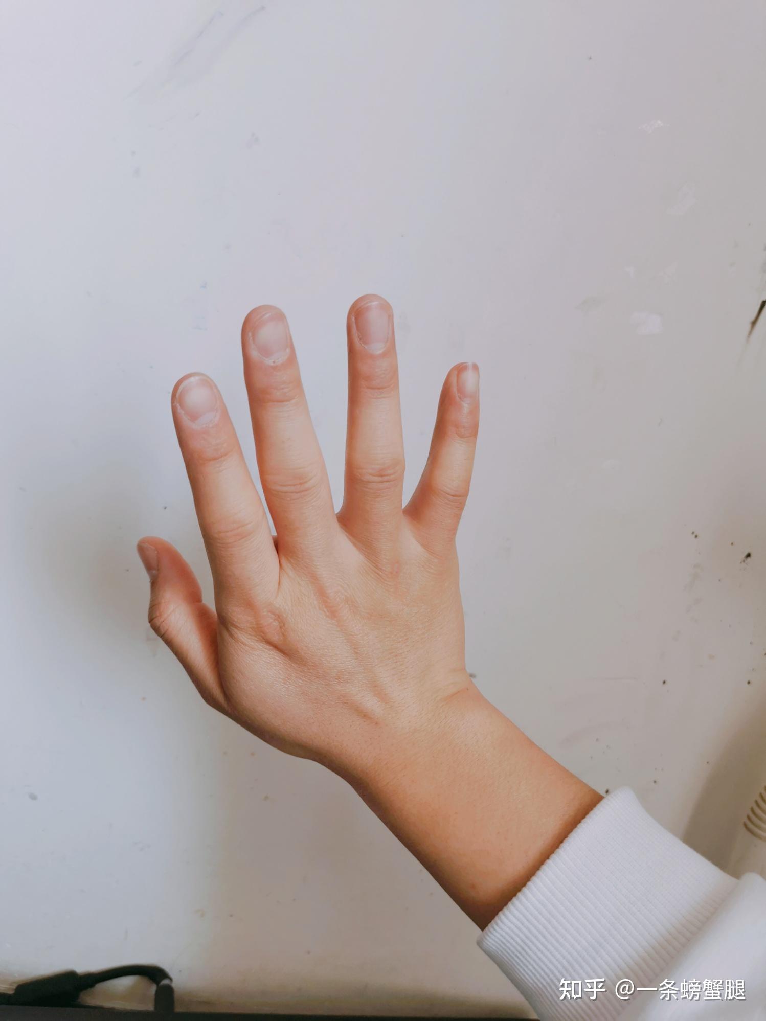 胖胖的男生拥有一双小胖手是什么体验? - 知乎