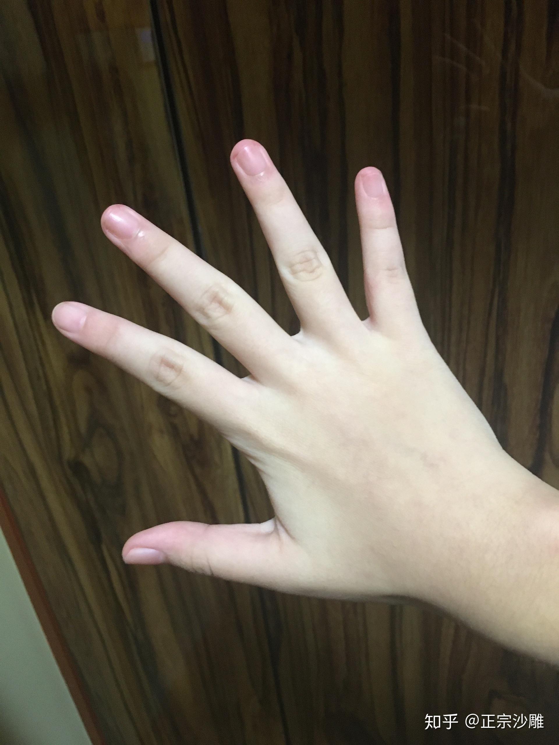 之前没有发现自己的手胖,现在感觉自己的手上的肉好多啊,怎么才让自己