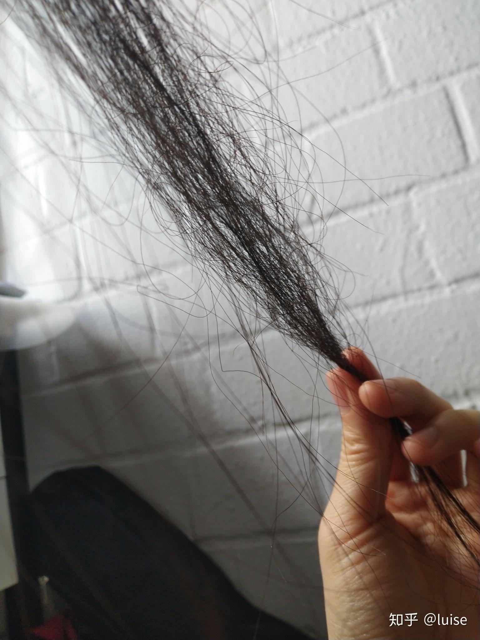 为什么我会有部分头发的发尾像钢丝一样弯曲是什么原因造成的?