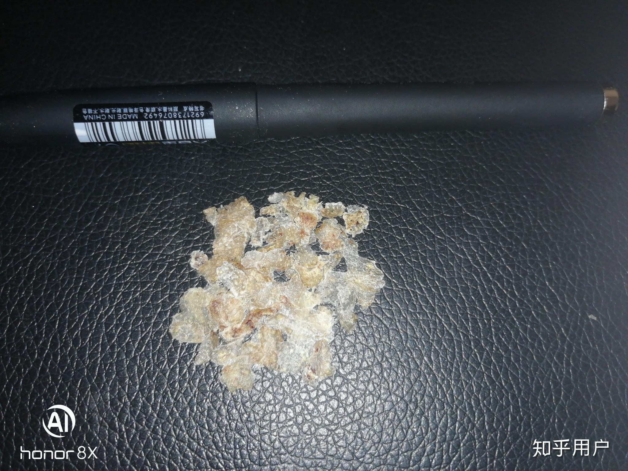 见过的最大头皮屑多大