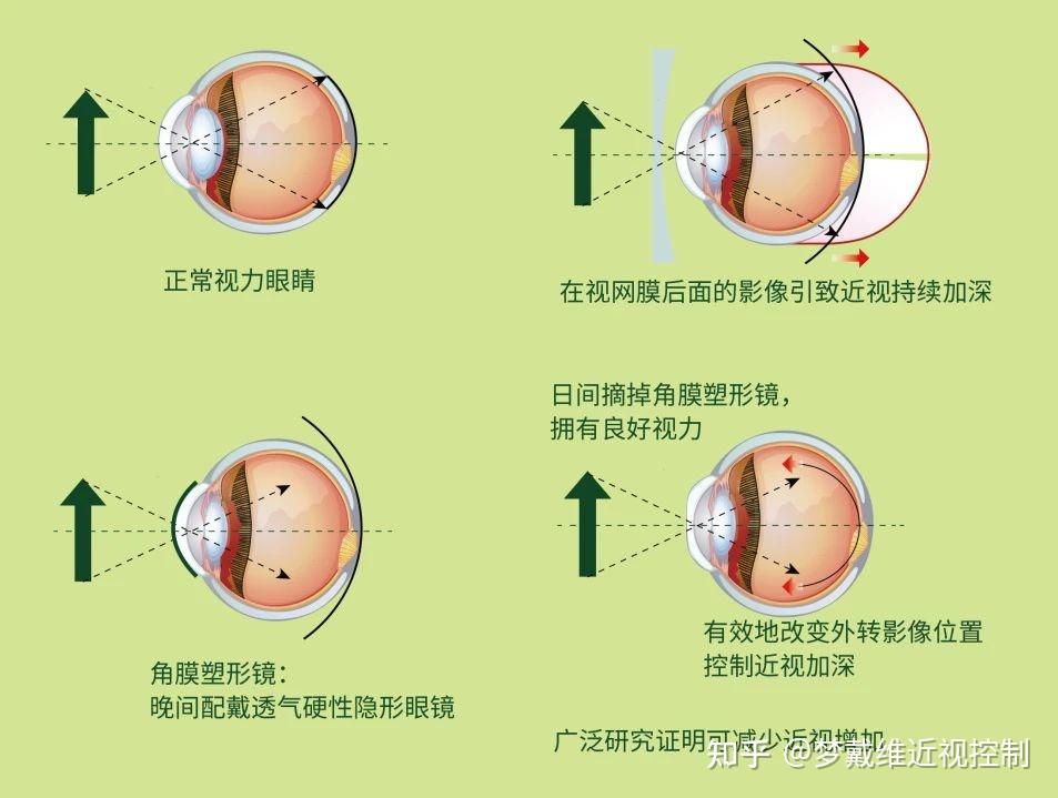 虚拟眼镜最新资讯-快科技--科技改动未来