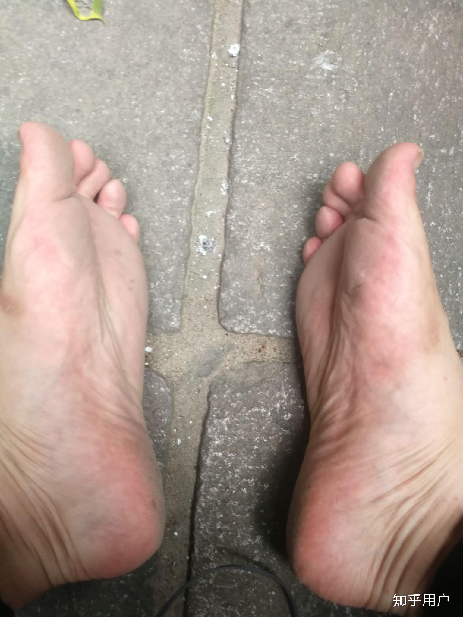 赤脚走路脚底很黑是什么样的体验? - 知乎