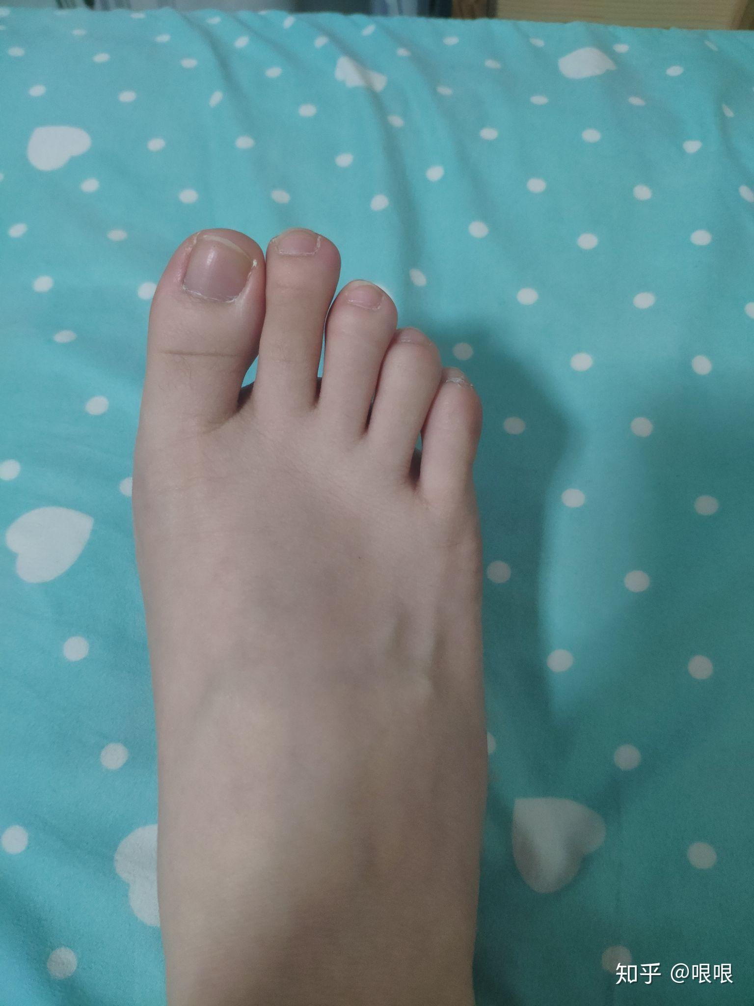 69希腊脚69真的69很少见69吗69