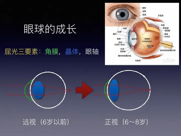 眼科医生说的屈光不正是什么? - 知乎