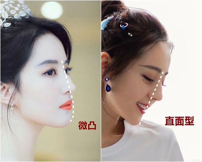 正颌做直面还是微凸好,直面和微凸有什么区别?四个标准让你避坑垃圾医院 - 知乎