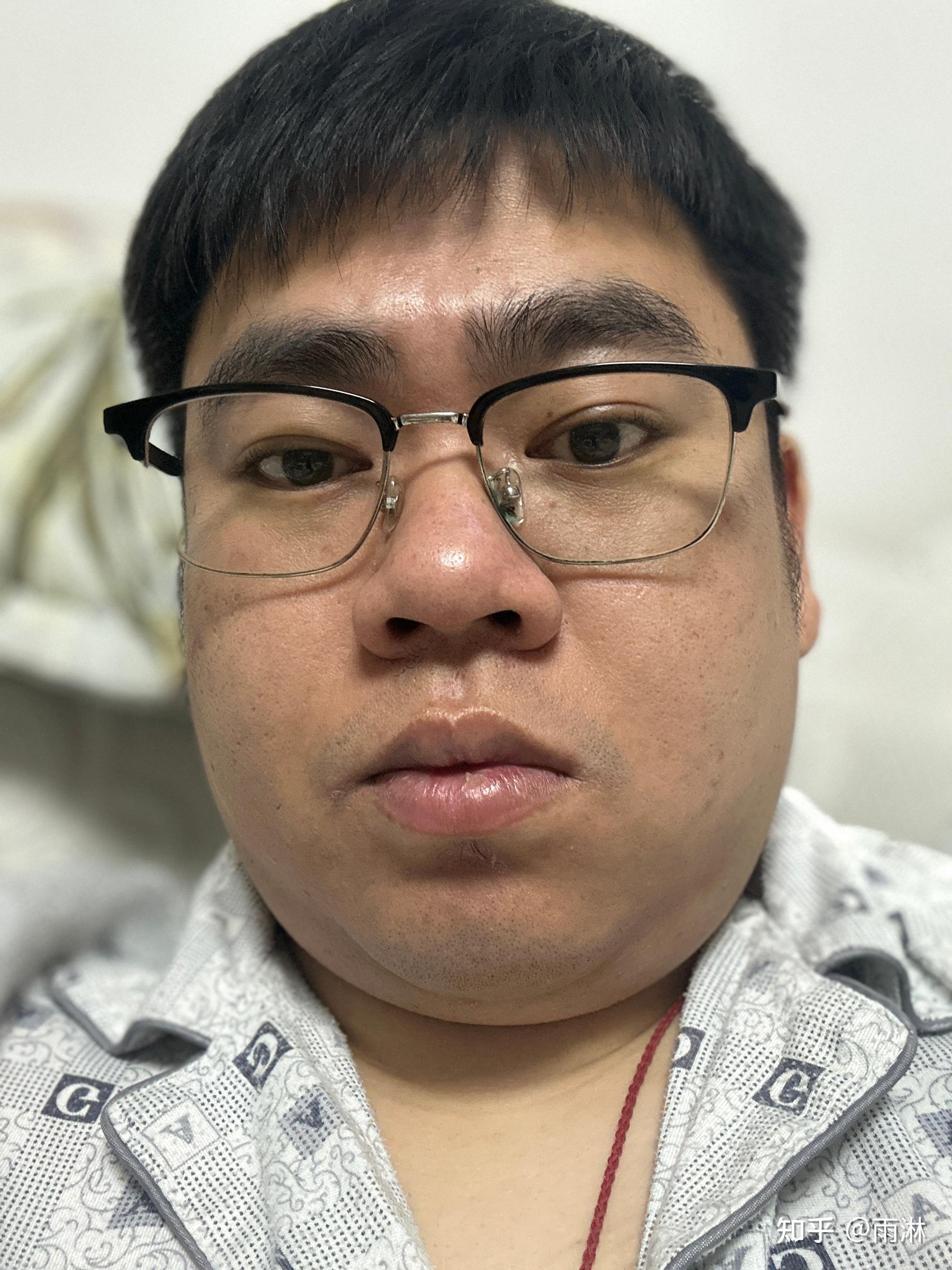 油腻大叔减肥之路