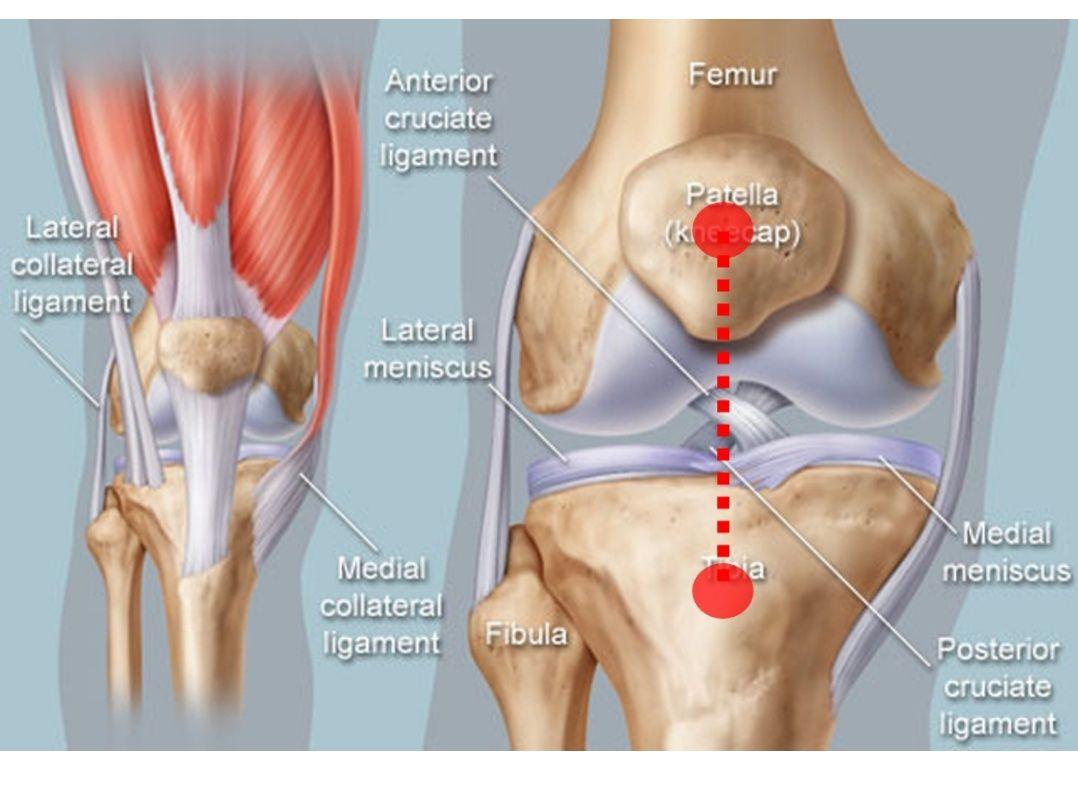 髌腱炎可以治好吗? - 知乎