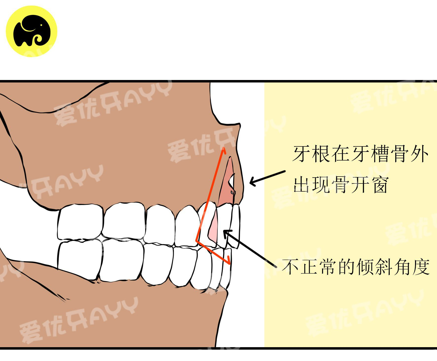 能否科普一下骨开窗