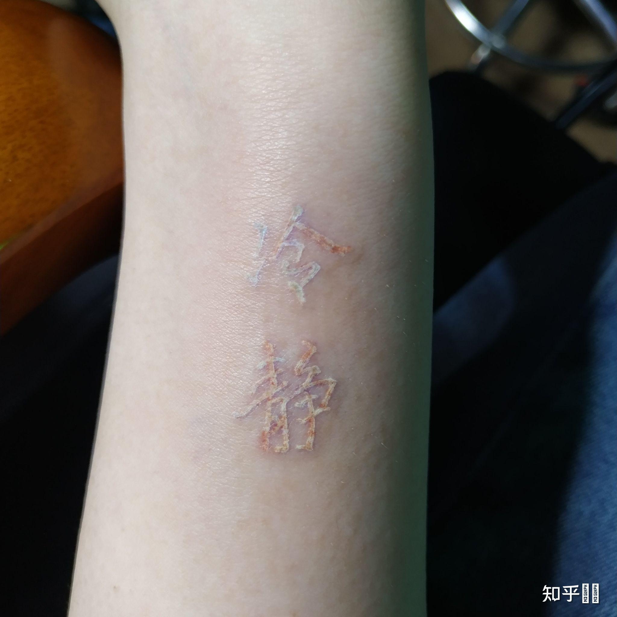 想纹个白色的纹身有纹过白色的纹身的吗有什么缺点吗听说会变黄如图想